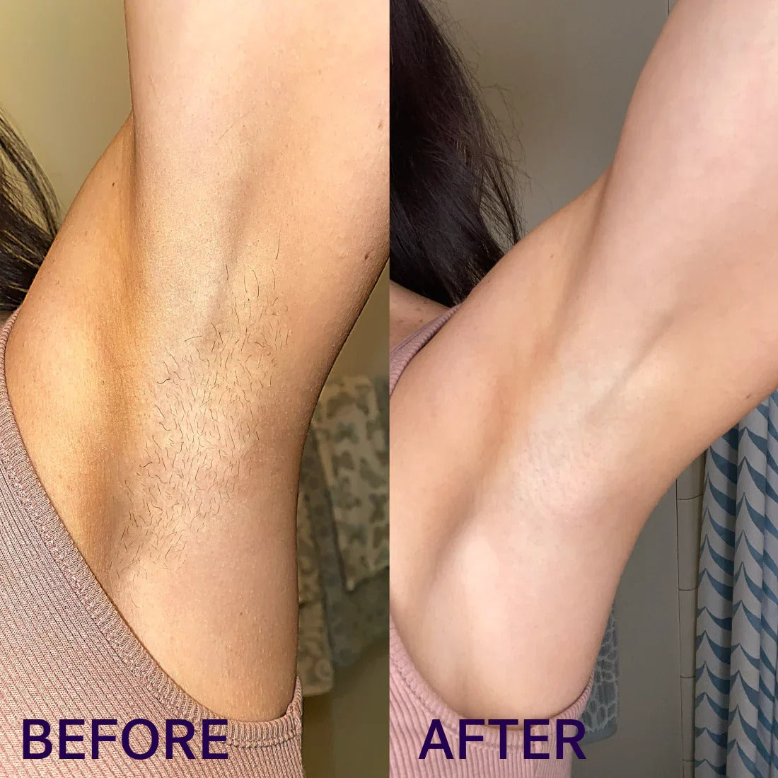 Gentle Hair Removal Cream ✨ Smooth Skin, No Pain — Perfect for Sensitive Skin 💜