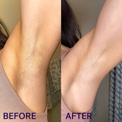 Gentle Hair Removal Cream  ✨ Smooth Skin, No Pain — Perfect for Sensitive Skin 💜